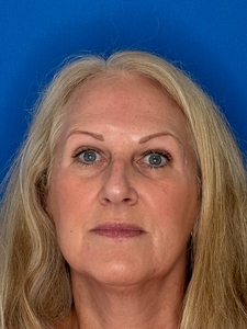 Lynne Winslow 10/09/24-10/26/24-after