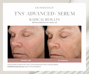 TNS Advanced+ Serum-before