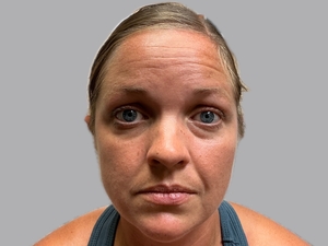 Compare-before