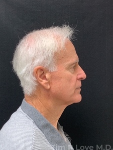 Compare-before