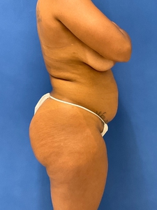 Adrianne Howard-after