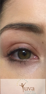 1 Lash Lift Treatment at Yuva-before