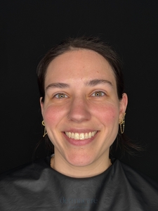 Danielle Glass, RN. - Versa-before