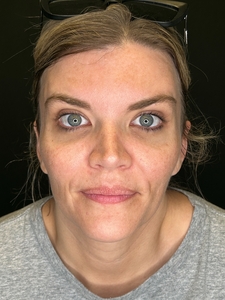 Compare-after