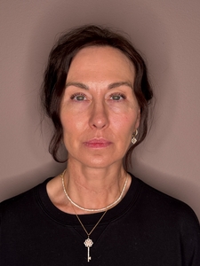 Michelle Sahinler- Hylenex x3-after