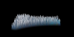 3D Pore Congestion on Cheek Before and After Hydroglow Facial-before