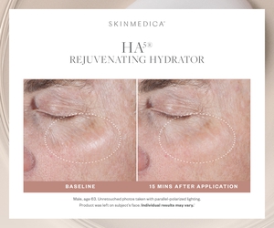 HA5 Rejuvenating Hydrator-before