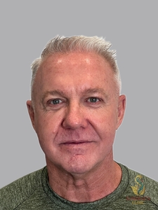 Nouvaderm 1 treatment-before