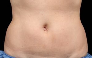 -after
