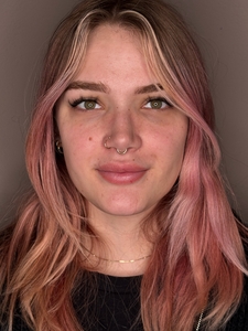 Sydney Burns- Hylenex eyes-after