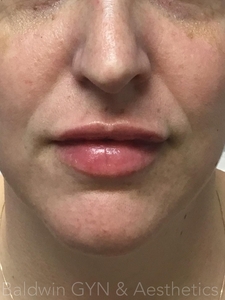 -after