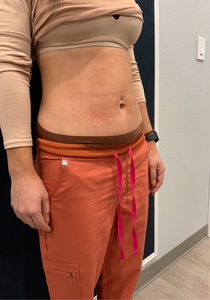 Immediately Following-after