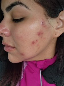 Dr. Ayala before-before