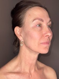 Michelle Sahinler- Moxi FNC-after