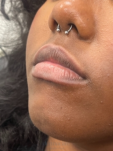 Whitney Devall RN. - Versa-before