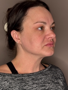 Kayla Moers- Moxi-after