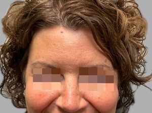 Compare-after