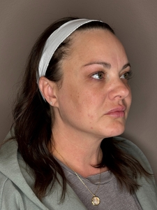 Kayla Moers- Moxi-before