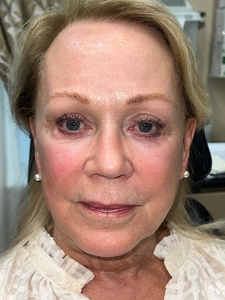 Compare-after