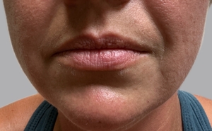 Compare-before