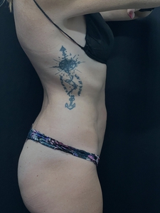 LAL-central abdomen + waist-before