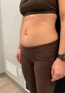 Immediately Following-before