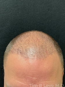 Compare-after