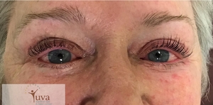 Lash lift at Yuva-after
