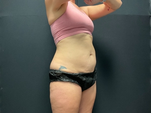 Compare-after