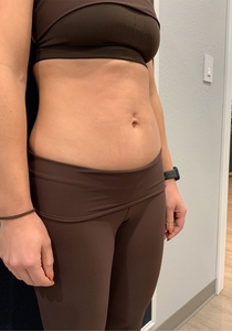 Immediately Following-before