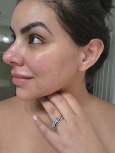 Dr. Ayala's Journey-after