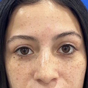 Lash Lift #1-before