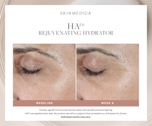 HA5 Rejuvenating Hydrator-before