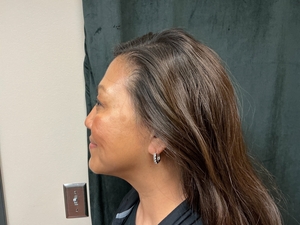 Compare-after