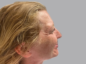 Compare-before