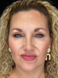 Neuromodulators-after