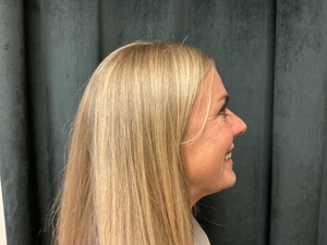 Compare-before