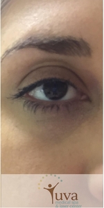 1 lash lift at Yuva-before