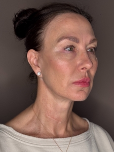 Michelle Sahinler- Moxi FNC-before