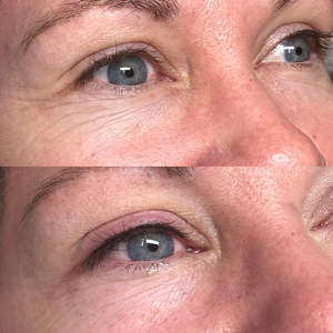 Lash Enhancement-before