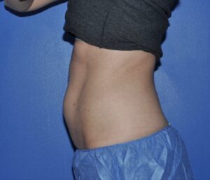 -before