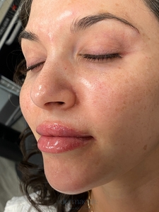 Whitney Devall RN.-after