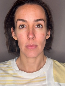 Laura Henderson - Moxi-before