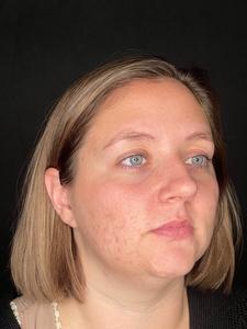 Trisha Sheehan LME.-after