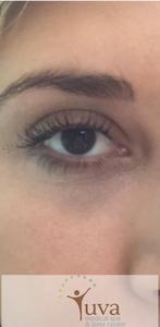 1 lash lift at Yuva-after