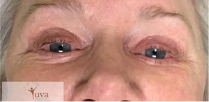 Lash lift at Yuva-before