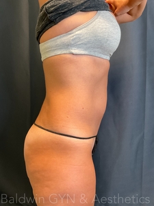 7 mos-after
