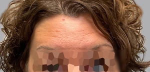 Compare-after