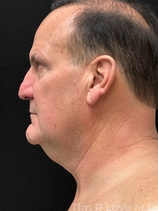 Compare-before
