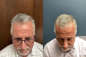 Compare after 3 TX's-before